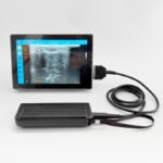 -X8 Color Doppler Ultrasound Scanner 128 Elements 32 Channels Pets Diagnosis Pregnancy Checking - Image 4